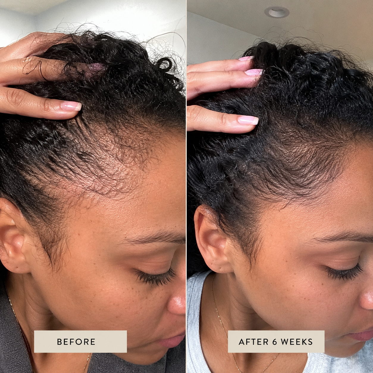 Before and after result image showing edges after six weeks